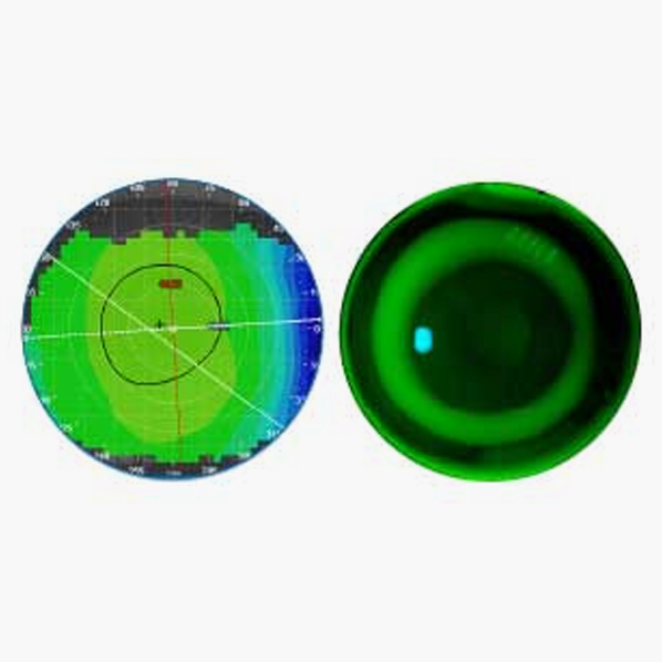 Lucid Korea 프리미어 드림렌즈